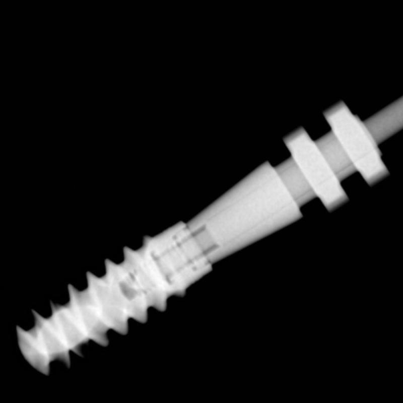 Radiograph of a dental implant
